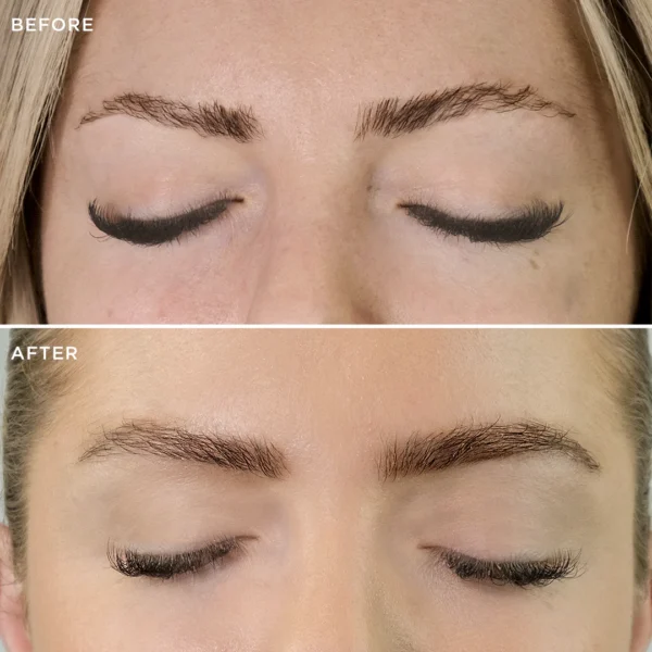 brow code multi peptide growth serum before after bg 01