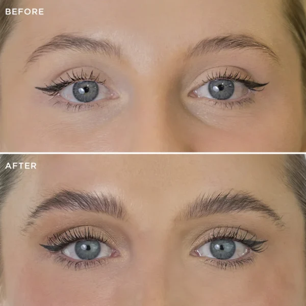 brow code multi peptide growth serum before after bg 02
