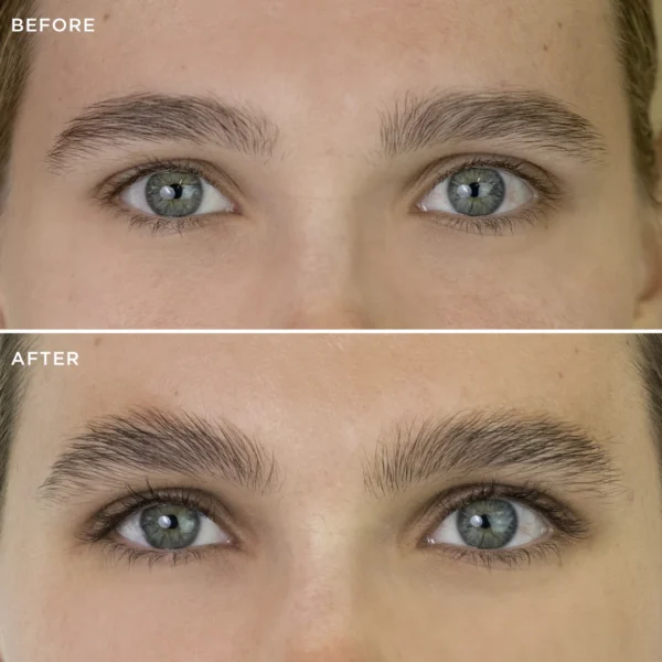 brow code multi peptide growth serum before after bg 03
