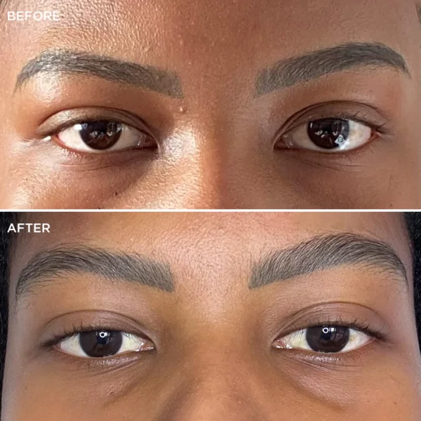 brow code multi peptide growth serum before after bg 04