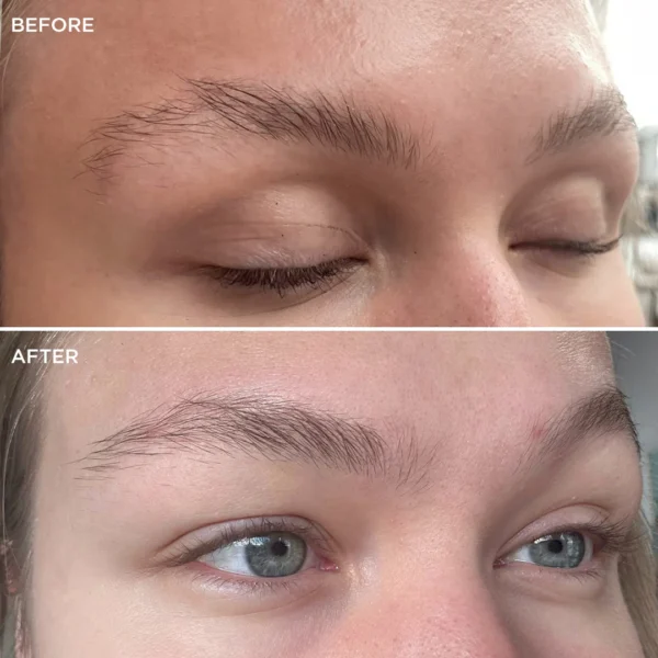 brow code multi peptide growth serum before after bg 05