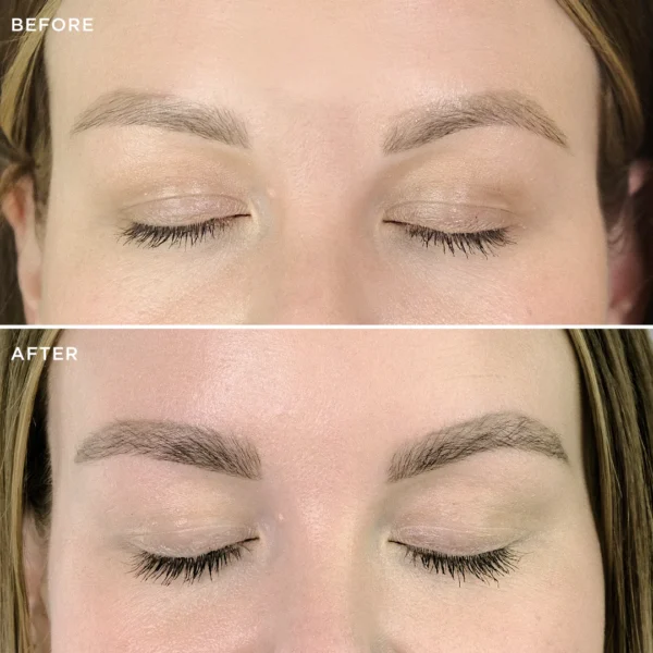 brow code multi peptide growth serum before after bg 06